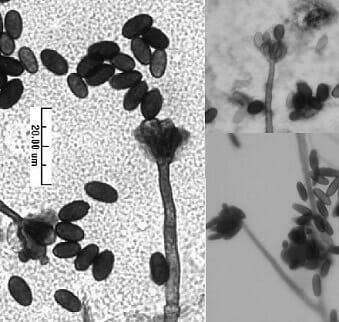 Spore di muffa nera Stachybotrys osservate al microscopio